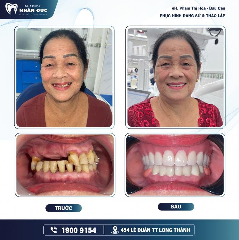 Đội ngũ y bác sĩ tại phòng khám Nha Khoa Nhân Đức Long Thành